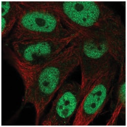 GAL3ST4 Antibody, Novus Biologicals 100&mu;L; Unlabeled:Antibodies, Polyclonal