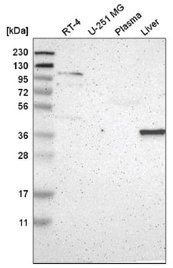 Galectin-8 Antibody, Novus Biologicals:Antibodies:Primary Antibodies