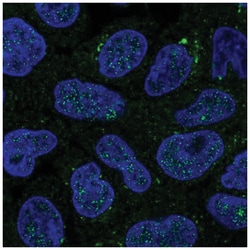 GALNT14 Antibody, Novus Biologicals 100&mu;L; Unlabeled:Antibodies, Polyclonal