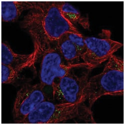 GALNT8 Antibody, Novus Biologicals 100&mu;L; Unlabeled:Antibodies, Polyclonal
