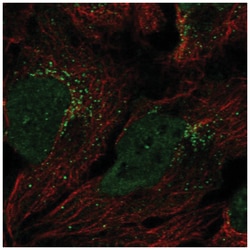 Gamma-Glutamyltransferase 7 Antibody, Novus Biologicals:Antibodies:Primary