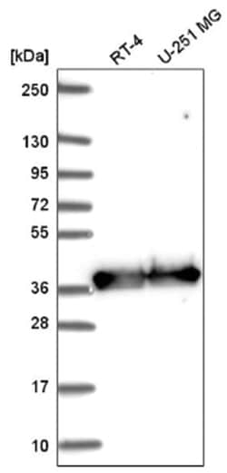 GAPDH Antibody, Novus Biologicals 100&mu;L; Unlabeled:Antibodies, Polyclonal