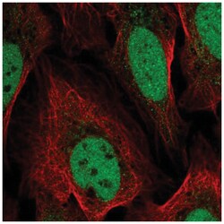 GAS41 Antibody, Novus Biologicals:Antibodies:Primary Antibodies