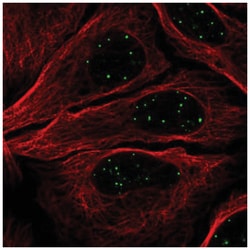 GATA-4 Antibody, Novus Biologicals:Antibodies:Primary Antibodies