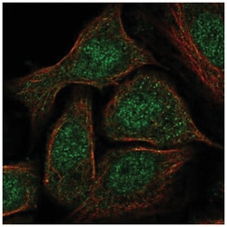 GATA-5 Antibody, Novus Biologicals 25 &mu;L, Unlabeled:Antibodies, Polyclonal