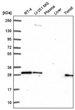 GBX2 Antibody, Novus Biologicals:Antibodies:Primary Antibodies