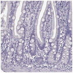 GCAP1 Antibody, Novus Biologicals 100&mu;L; Unlabeled:Antibodies, Polyclonal