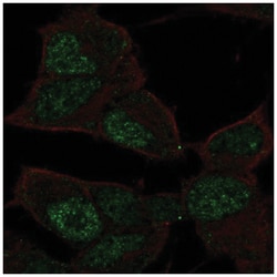 GCFC2 Antibody, Novus Biologicals 100&mu;L; Unlabeled:Antibodies, Polyclonal