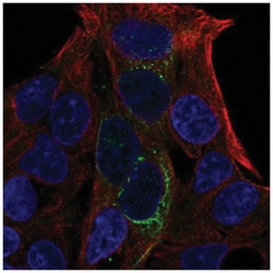 GCKR Antibody, Novus Biologicals 25 &mu;L:Antibodies, Polyclonal