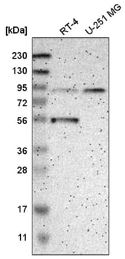 GCS1 Antibody, Novus Biologicals 100&mu;L; Unlabeled:Antibodies, Polyclonal
