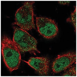 GDNF Antibody, Novus Biologicals 100&mu;L; Unlabeled:Antibodies, Polyclonal