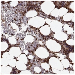 GEF-H1 Antibody, Novus Biologicals 25 &mu;L, Unlabeled:Antibodies, Polyclonal