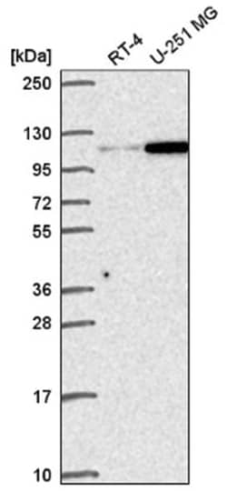 Gemin 4 Antibody, Novus Biologicals 100&mu;L; Unlabeled:Antibodies, Polyclonal