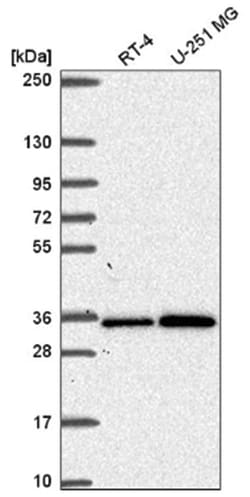 GEMIN2 Antibody, Novus Biologicals:Antibodies:Primary Antibodies