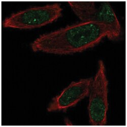 GEMIN6 Antibody, Novus Biologicals 25 &mu;L, Unlabeled:Antibodies, Polyclonal
