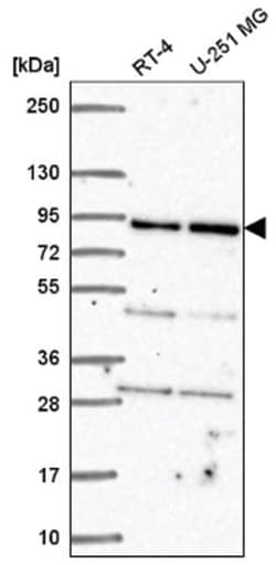 GFM1 Antibody, Novus Biologicals 25 &mu;L:Antibodies, Polyclonal
