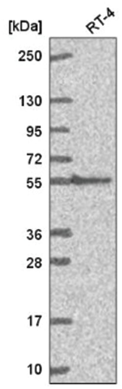GGT1 Antibody, Novus Biologicals 100&mu;L; Unlabeled:Antibodies, Polyclonal