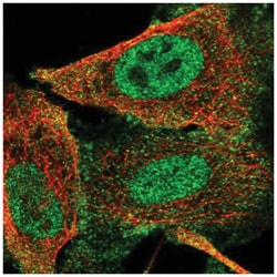 GLI-1 Antibody, Novus Biologicals 25 &mu;L:Antibodies, Polyclonal