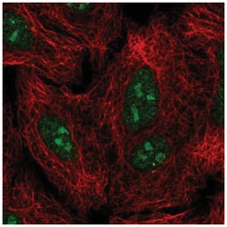 GLI-2 Antibody, Novus Biologicals 25 &mu;L, Unlabeled:Antibodies, Polyclonal
