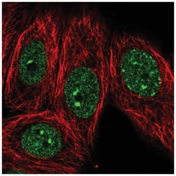 GLP/EHMT1 Antibody, Novus Biologicals 25 &mu;L, Unlabeled:Antibodies, Polyclonal