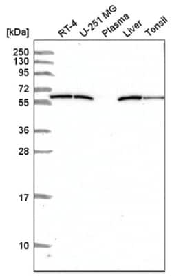 Glucose 6 phosphate isomerase Antibody, Novus Biologicals 25 &mu;L, Unlabeled:Antibodies,