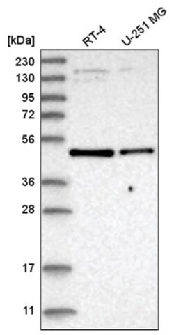 Glut2 Antibody, Novus Biologicals:Antibodies:Primary Antibodies