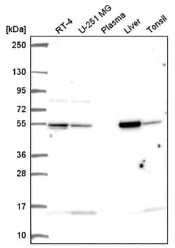 Glutamate Dehydrogenase Antibody, Novus Biologicals:Antibodies:Primary