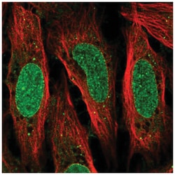 glutamine rich 2 Antibody, Novus Biologicals 100&mu;L; Unlabeled:Antibodies,
