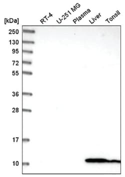 Glutaredoxin 1/GLRX1 Antibody, Novus Biologicals 100&mu;L; Unlabeled:Antibodies,