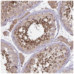 Glutathione Peroxidase 4/GPX4 Antibody, Novus Biologicals 100&mu;L; Unlabeled:Antibodies,