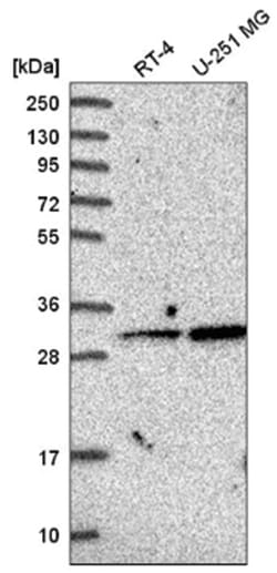 GLYAT Antibody, Novus Biologicals 100&mu;L; Unlabeled:Antibodies, Polyclonal
