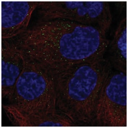 GM-CSF Antibody, Novus Biologicals:Antibodies:Primary Antibodies