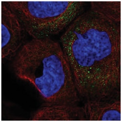 GM-CSF Antibody, Novus Biologicals 25 &mu;L:Antibodies, Polyclonal