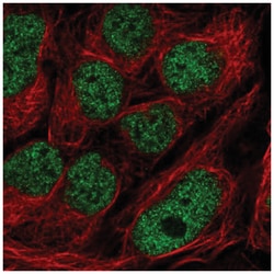 GMEB2 Antibody, Novus Biologicals:Antibodies:Primary Antibodies