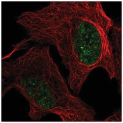 GMPR2 Antibody, Novus Biologicals 25 &mu;L, Unlabeled:Antibodies, Polyclonal