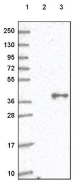 GNA11 Antibody, Novus Biologicals 100&mu;L; Unlabeled:Antibodies, Polyclonal