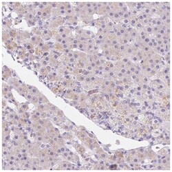 GnRHR Antibody, Novus Biologicals 100&mu;L; Unlabeled:Antibodies, Polyclonal