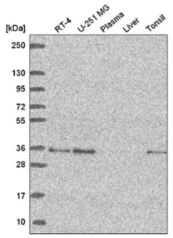 GOLPH3 Antibody, Novus Biologicals:Antibodies:Primary Antibodies