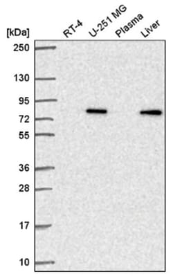 GPAM Antibody, Novus Biologicals 25 &mu;L, Unlabeled:Antibodies, Polyclonal