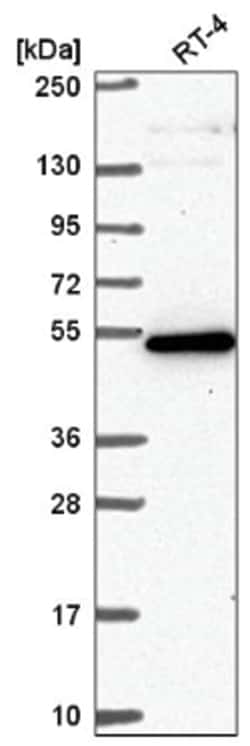 GPATCH4 Antibody, Novus Biologicals 100&mu;L; Unlabeled:Antibodies, Polyclonal