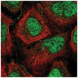 GPCPD1 Antibody, Novus Biologicals 25 &mu;L:Antibodies, Polyclonal