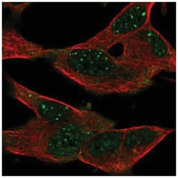 GPR155 Antibody, Novus Biologicals 100&mu;L; Unlabeled:Antibodies, Polyclonal