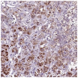 GPR98 Antibody, Novus Biologicals 100&mu;L; Unlabeled:Antibodies, Polyclonal