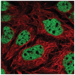 GPS2 Antibody, Novus Biologicals 25 &mu;L, Unlabeled:Antibodies, Polyclonal