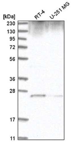 GRB2 Antibody, Novus Biologicals 100&mu;L; Unlabeled:Antibodies, Polyclonal