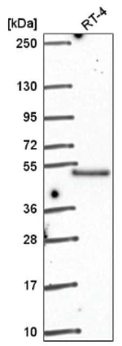 GRINL1A Antibody, Novus Biologicals 25 &mu;L, Unlabeled:Antibodies, Polyclonal