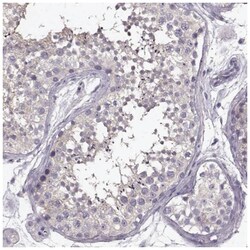 GRK1 Antibody, Novus Biologicals 100&mu;L; Unlabeled:Antibodies, Polyclonal