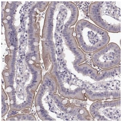 GRK1 Antibody, Novus Biologicals 100&mu;L; Unlabeled:Antibodies, Polyclonal