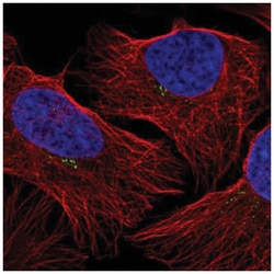 GRK2 Antibody, Novus Biologicals:Antibodies:Primary Antibodies