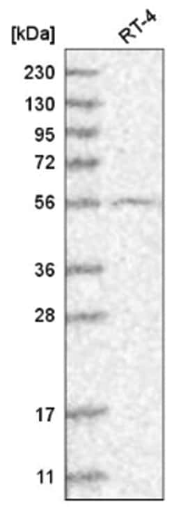 GRK4 Antibody, Novus Biologicals:Antibodies:Primary Antibodies
